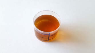DXM reference photo